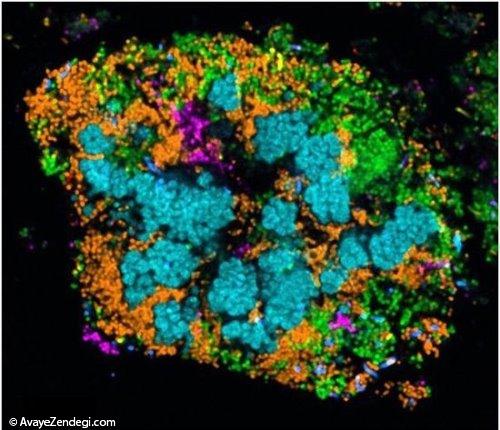  تصاویر رنگارنگ از میکروب‌های دندان 